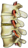 spine sm.jpg